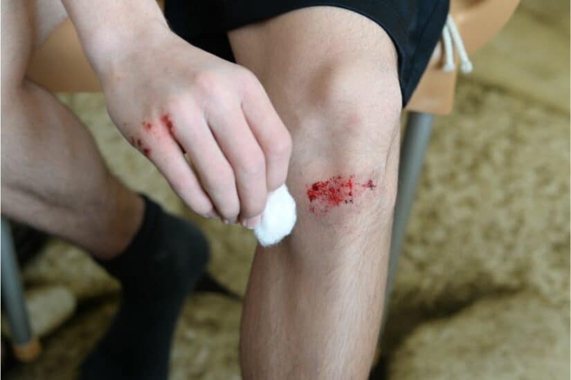 Knee injury with blood and bandage, person cleaning the wound with cotton.
