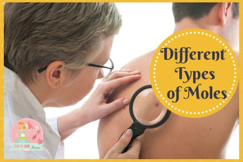 Different types, appearances, and what they mean for skin health.