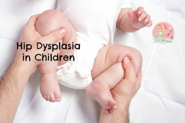 Hip dysplasia in children