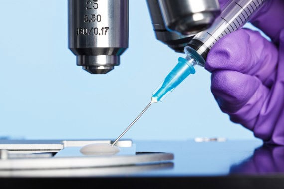 Innovative fertility treatment for men struggling with infertility.