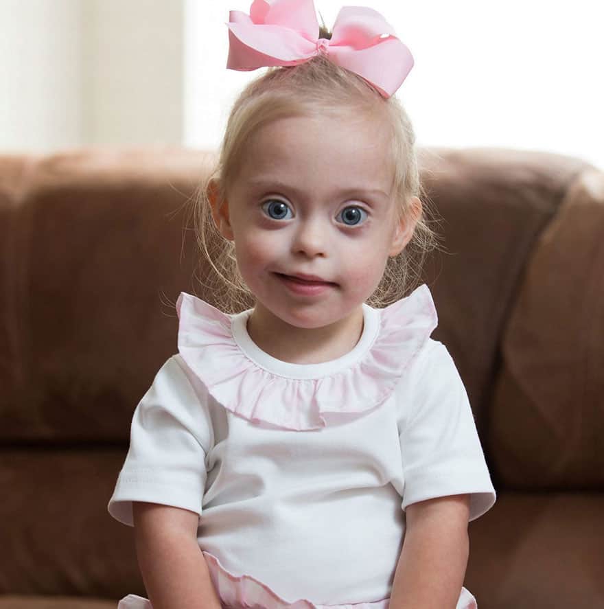 Down Syndrome Girl Smiling with Pink Bow.
