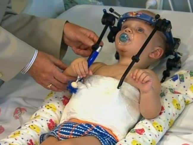 Child with neck injury connected to medical devices in hospital bed.