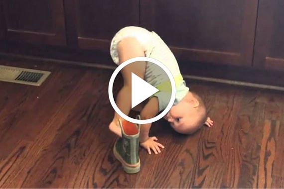 Baby with a boot on their foot, bending over on the floor.