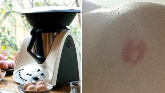 Mum and Baby Badly Burned After Another Case of Thermomix Explosions | Stay at Home Mum