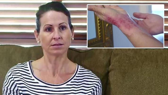 Mum Becomes One of 87 Cases of Thermomix Explosions | Stay at Home Mum