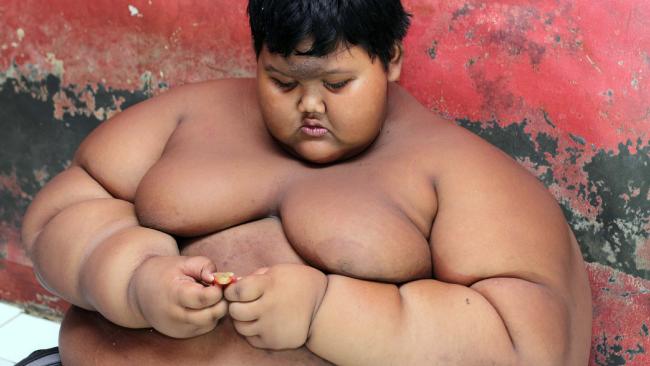 10-Year-Old Boy Weighing 192Kg is World’s Heaviest Kid