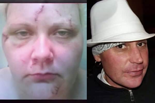 Boy With Autism Saves Mum From Attacker