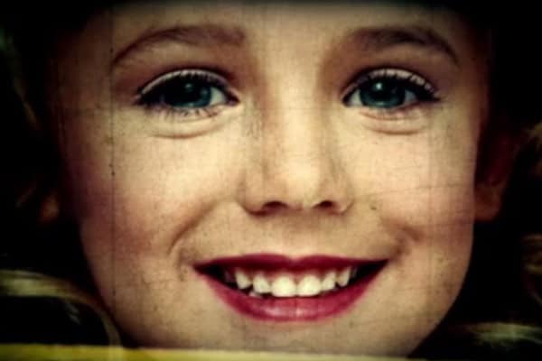 Child with a big smile, showing missing front teeth and blue eyes.