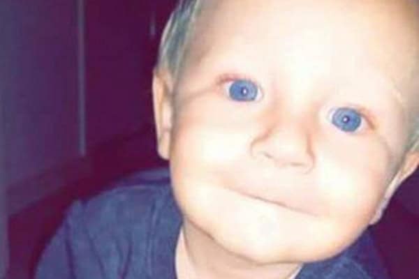 Toddler Who Contracted Meningococcal Disease Has Passed Away