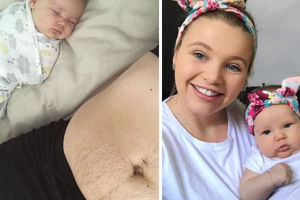 Mum Shares Photo of Her Postpartum Body To Urge Women To Love Their Bodies | Stay at Home Mum