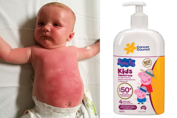 AMA Says Peppa Pig Sunscreen is Safe For Most People | Stay at Home Mum
