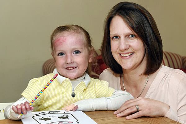 Meet 'Butterfly Girl': Four-Year-Old Girl Has Skin That Tears Off With The Slightest Touch | Stay at Home Mum