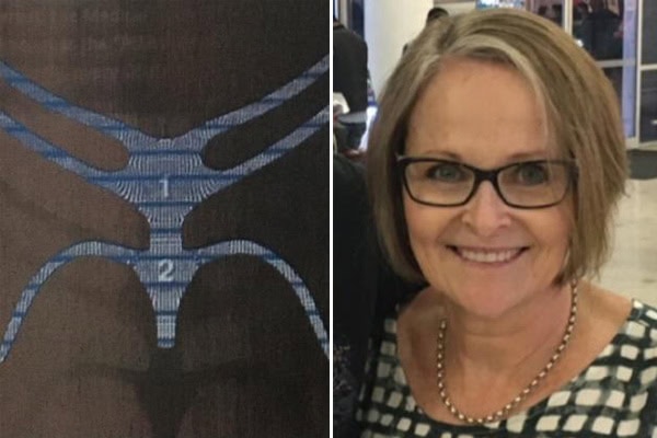 Women Sue Manufacturers of Pelvic Mesh Implants For Causing Catastrophic Injuries To Their Internal Organs | Stay at Home Mum