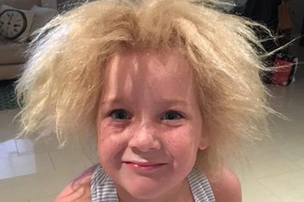 Girl with unmanageable, fluffy blonde hair and bright blue eyes.