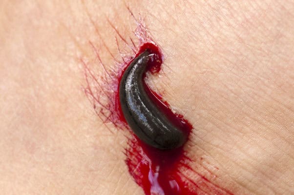 Semen Facials and Other Bizarre Beauty Treatments