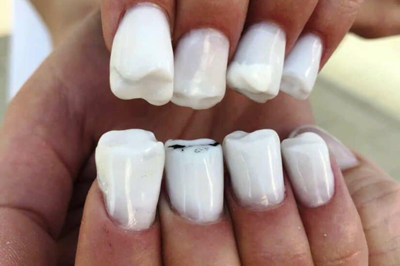Close-up of poorly done white nail polish on uneven nails.